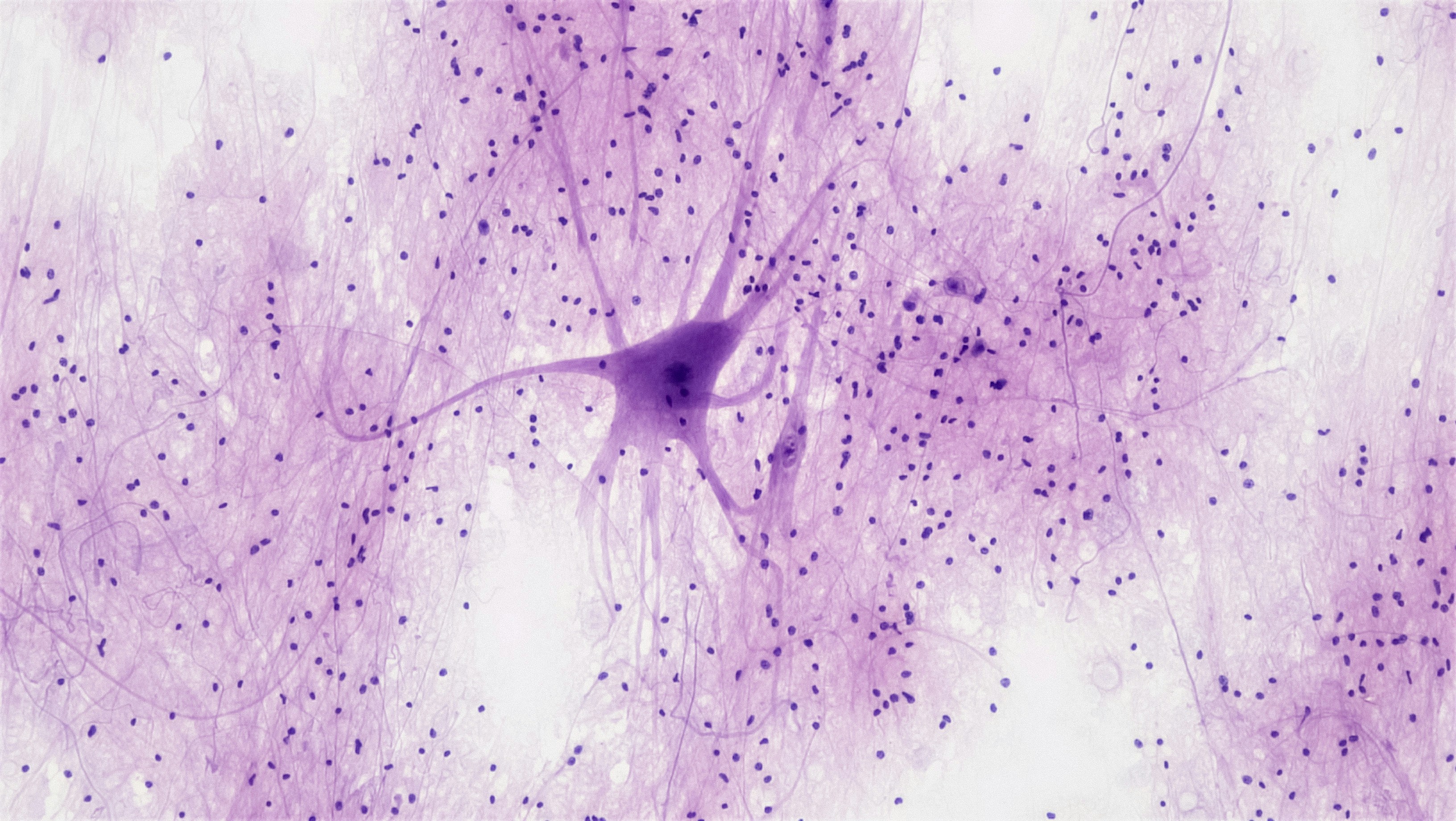How Memories Are Formed: A Journey Inside the Brain